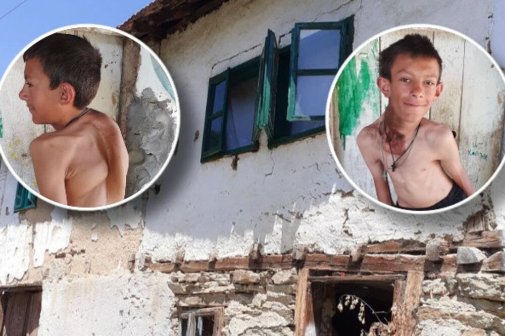 MARKO IMA POTKOŽNE TUMORE I NEMA USLOVA ZA ŽIVOT! Boravi u kući staroj 200 godina i ima samo JEDNU ŽELJU (FOTO)