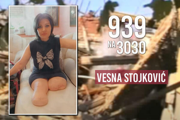 VESNA JE ZBOG NATO BOMBI OSTALA BEZ OBE NOGE: 7. novembar je poslednji ROK da joj POMOGNEMO, fali 5.000 EVRA!