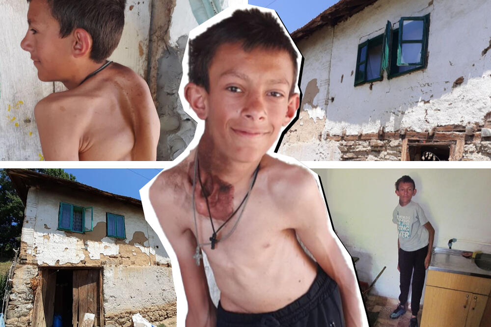 SEĆATE SE MARKA KOJI ŽIVI U STOGODIŠNJOJ KUĆI I IMA POTKOŽNE TUMORE? Imamo još 8 DANA da mu POMOGNEMO (FOTO)