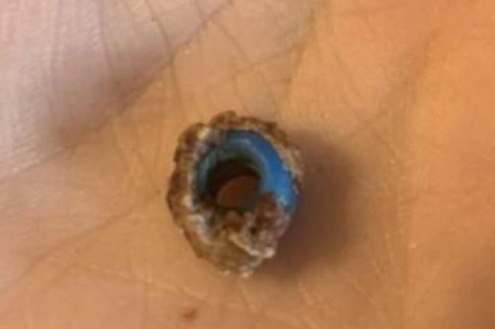 MISLILA JE DA JE MUČE SINUSI, A ONDA JE U NOSU UGLEDALA JEZIVU STVAR: Ono što je izvadila OSTAVIĆE VAS U ŠOKU VIDEO