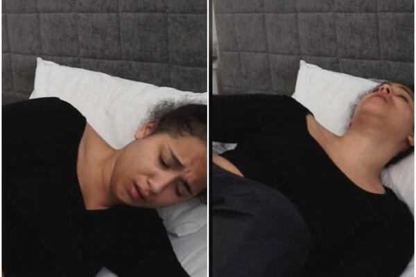 DEVOJKA SA ALERGIJOM NA VODU OBJAŠNJAVA KAKO SE TUŠIRA: Groznica i bol su joj SVAKODNEVICA (VIDEO)