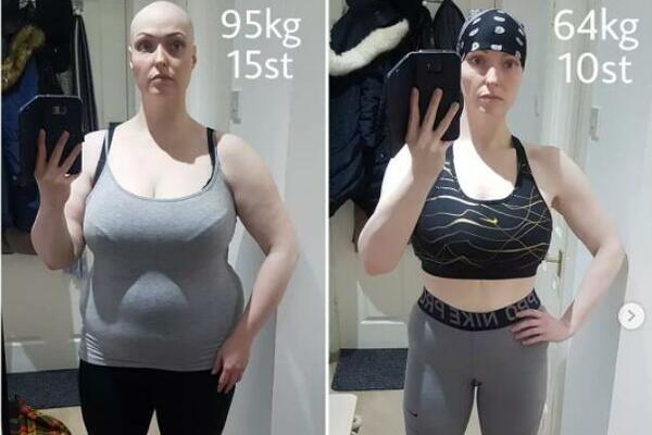 SMRŠALA SAM 36 KILOGRAMA: To nije postigla DIJETOM, uradila 1 stvar na koju NIKADA ne biste pomislili! (FOTO)