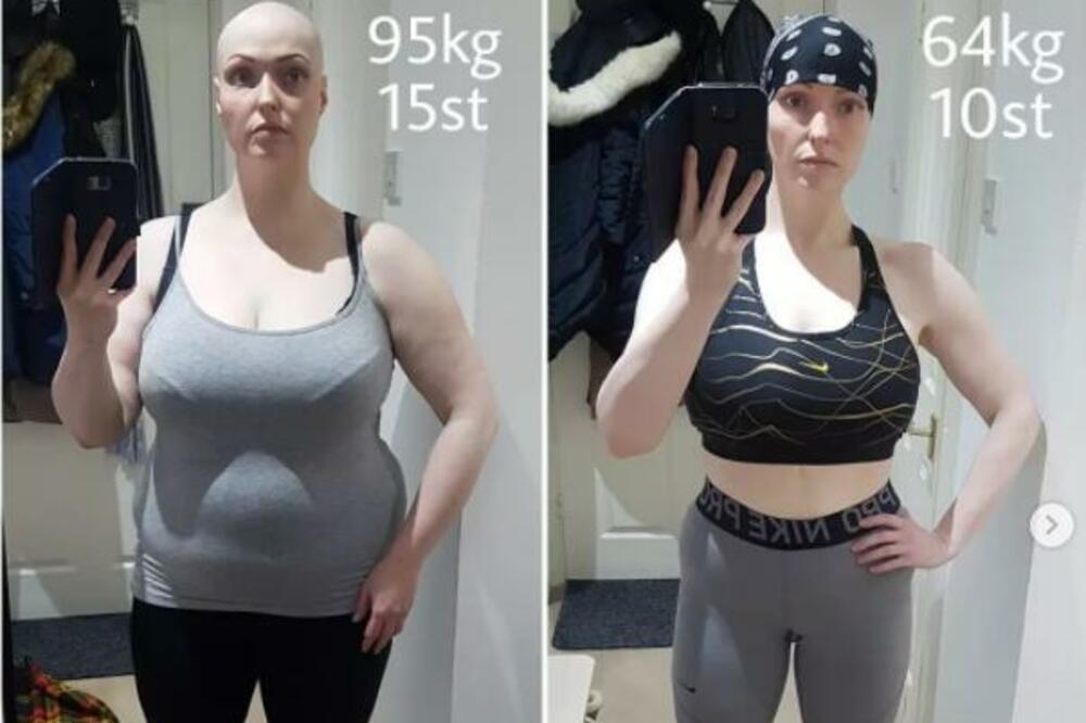 SMRŠALA SAM 36 KILOGRAMA: To nije postigla DIJETOM, uradila 1 stvar na koju NIKADA ne biste pomislili! (FOTO)