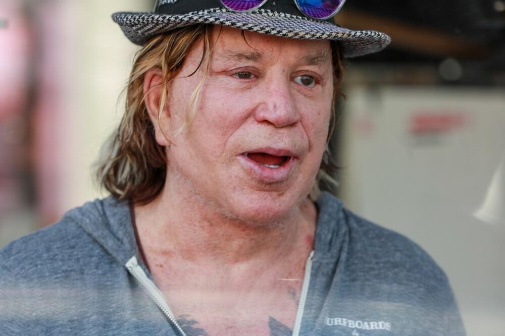 ŠTA MU SE DESILO? Poznati frajer se skroz IZOBLIČIO OD BOTOKSA, ljudi se KRSTE I LEVOM I DESNOM kad mu vide LICE