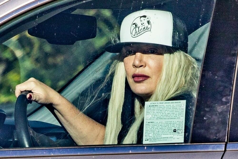 GLUMICA DOBILA OBOLJENJE ZBOG SOČIVA KOJE JE NOSILA I DOK JE SPAVALA: Sve je trajalo GODINAMA, a stanje je sad LOŠE