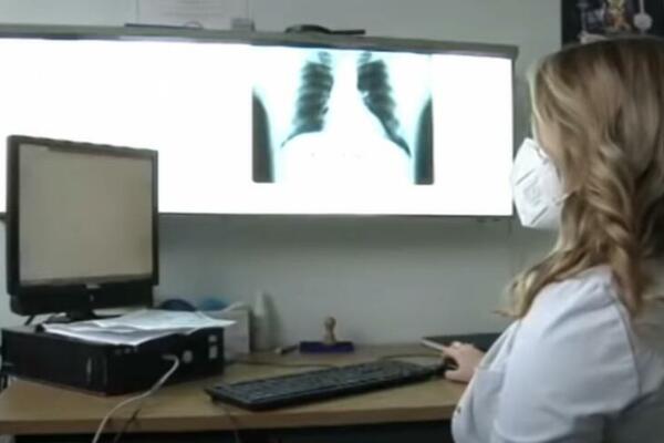 MISLITE DA STE SE REŠILI KOVIDA AKO STE GA PRELEŽALI? Tek tada sledi NAJGORI SCENARIO, evo i zašto