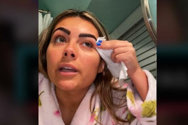 BAŠ JE ZAŽALILA: Otišla da jeftino tetovira OBRVE i prošla OVAKO! (VIDEO)