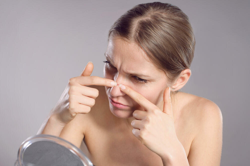 OPORAVITE KOŽU PRED TOPLIJE VREME! Prirodni losion sa PERŠUNOM ukloniće sve FLEKE