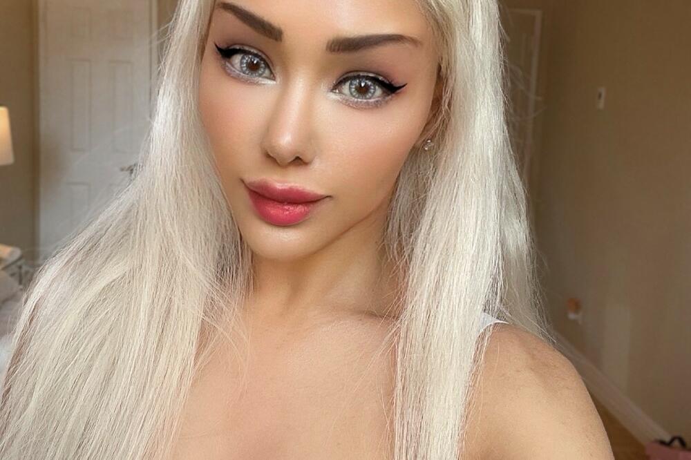 ONLYFANS MODEL I ČLANICA "MENSE"! Platila 15.000 dolara za operacije, više se ni ne seća kako je IZGLEDALA (FOTO)