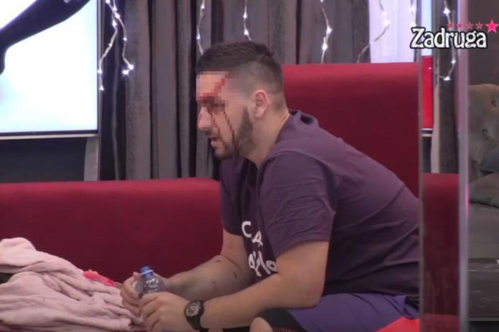 STRAVIČNA NOĆ U ZADRUZI! Pljuštale su PESNICE, šutiranja i nemilosrdne TUČE: Krv šikljala na sve strane! (VIDEO)