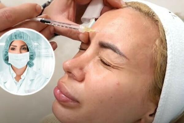 MISLE DA SU PAMETNI DA NE PLATE EDUKACIJU PA LJUDIMA NAPRAVE PAKAO: Dr Radenkov o botoksiranju putem JUTJUBA! FOTO