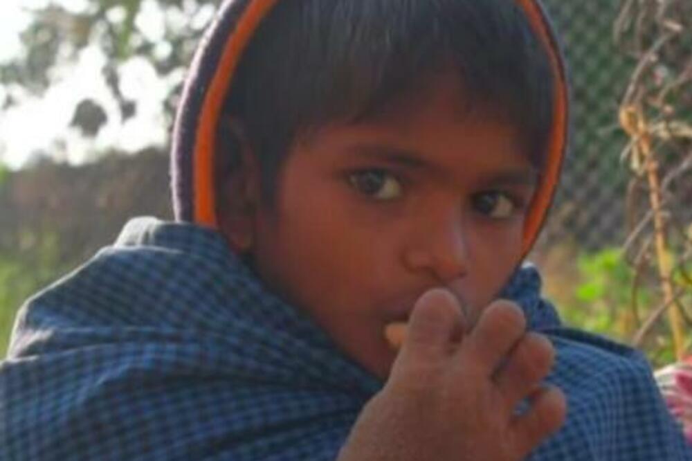 "RODITELJI NE DAJU DECI DA DOLAZE U NAŠU KUĆU": Devojčica pati od retke bolesti kože, rođena kao zdrava beba (FOTO)