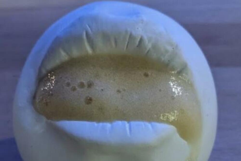 OVAJ VITAMIN NOSI NAJVEĆU OPASNOST OD PREDOZIRANJA! Srbi ga uzimaju u ogromnim količinama