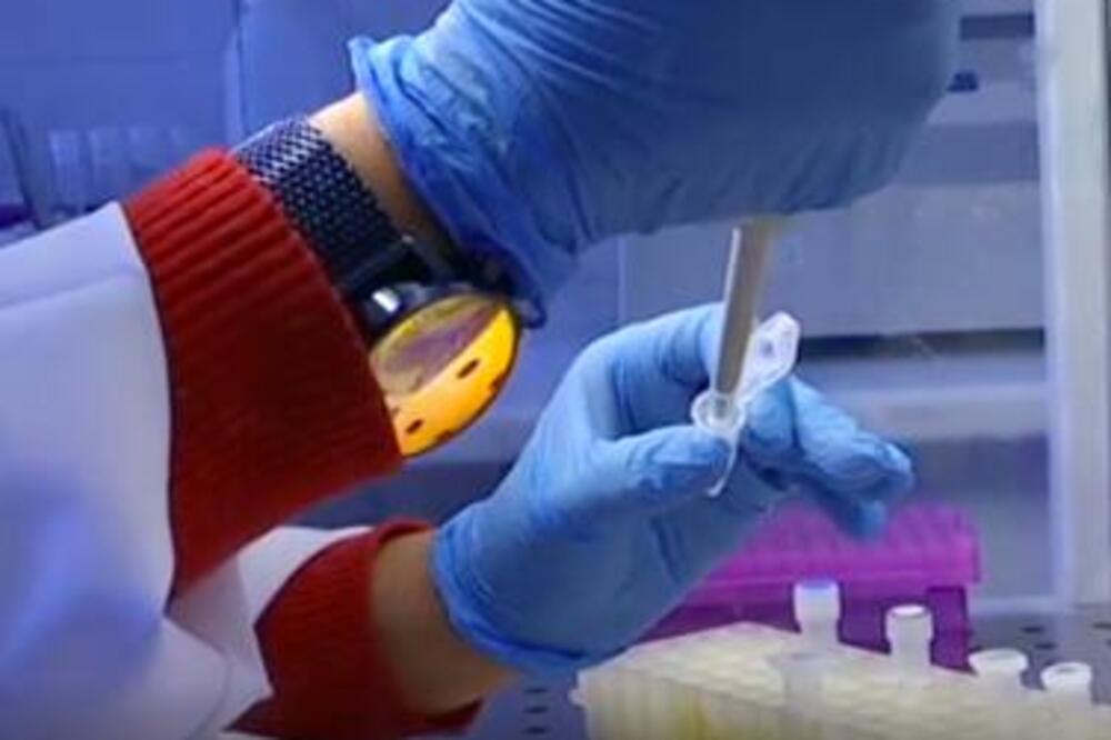 D-DIMER NE VADITE NA SVOJU RUKU! Srpski lekari upozorili, ove lekove ne smete piti