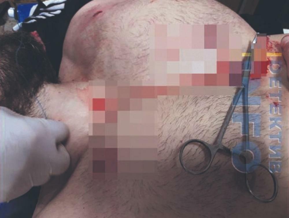 Ranjavanje, Zvicer, Policija