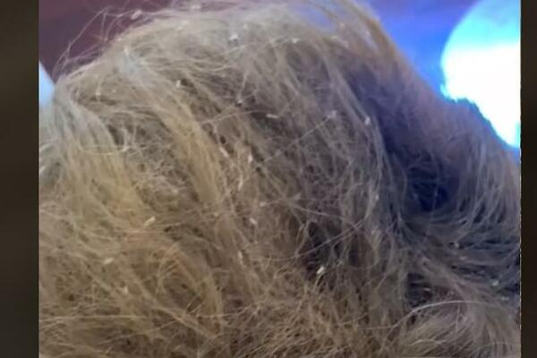 ISISALE JOJ SVU KRV SA GLAVE! Devojčica završila u BOLNICI zbog NAPASTI, majka KASNO primetila njene VAPAJE (VIDEO)