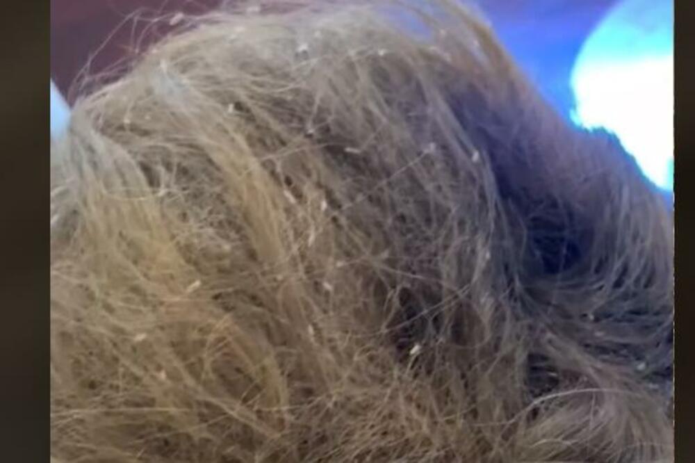 ISISALE JOJ SVU KRV SA GLAVE! Devojčica završila u BOLNICI zbog NAPASTI, majka KASNO primetila njene VAPAJE (VIDEO)