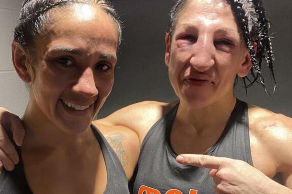 OVO NIJE HUMANO - PROMENJEN LIČNI OPIS! 236 UDARACA U LICE! Imala snage da se SMEJE NAKON BORBE! (FOTO)