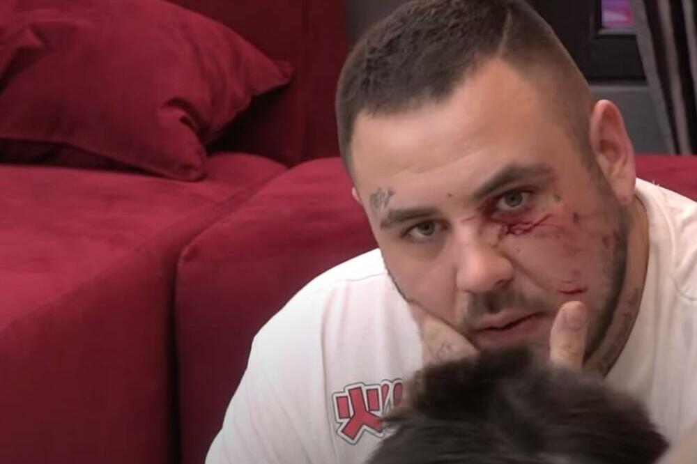 MEDIJI TVRDE DA JE MAJCI FILIPA CARA LOŠE: "Sin će mi ostati BEZ OKA"