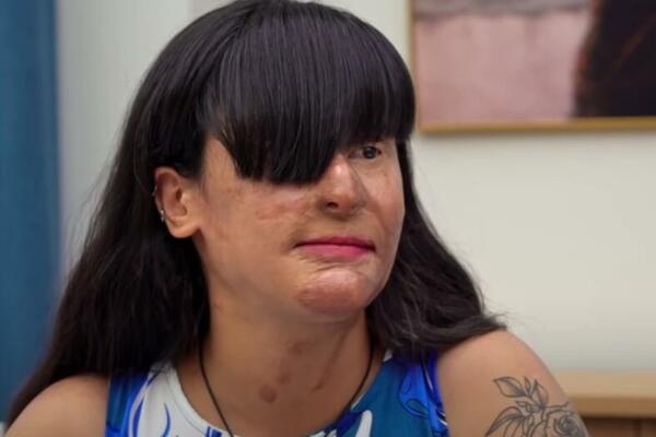 MOMAK JE POLIO KISELINOM I UNAKAZIO JE! 2 godine nakon KOBNOG trenutka, donela ODLUKU koja je ZAPREPASTILA sve