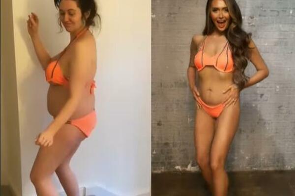 LEKARI JE UPOZORILI, PA SMRŠALA 30 KILOGRAMA! Šarlot postala neprepoznatljiva nakon transformacije