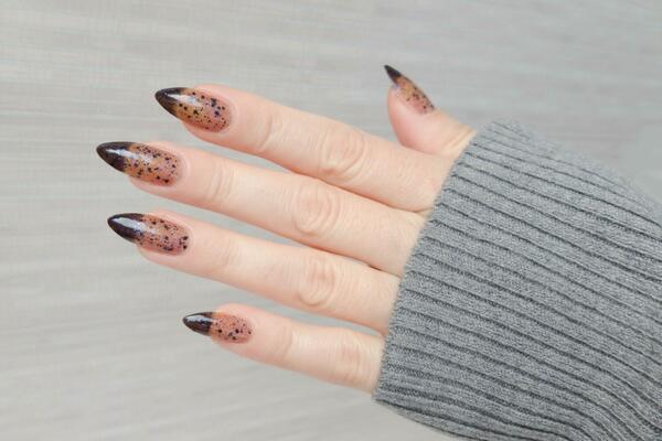 OVO JE PRAVA ISTINA O NADOGRADNJI NOKTIJU: Dr Pelemiš otkriva do kakvih KOMPLIKACIJA može doći!