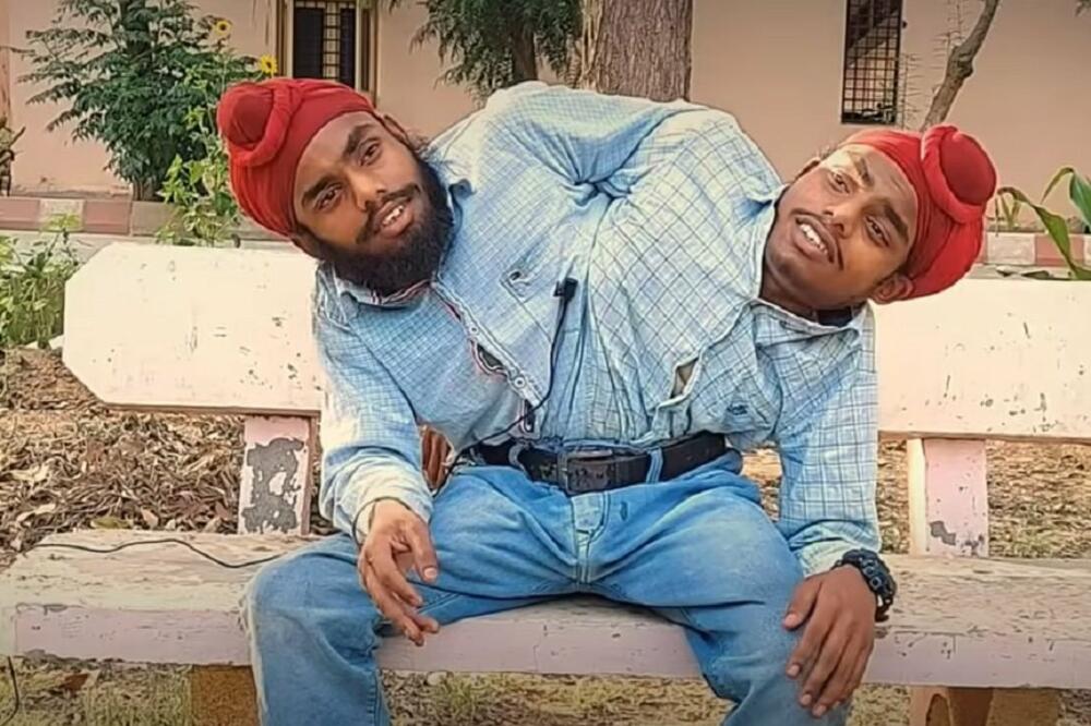 SIJAMSKE BLIZANCE SU RODITELJI NAPUSTILI ČIM SU SE RODILI! Sada im se desilo nešto NEVEROVATNO (VIDEO)