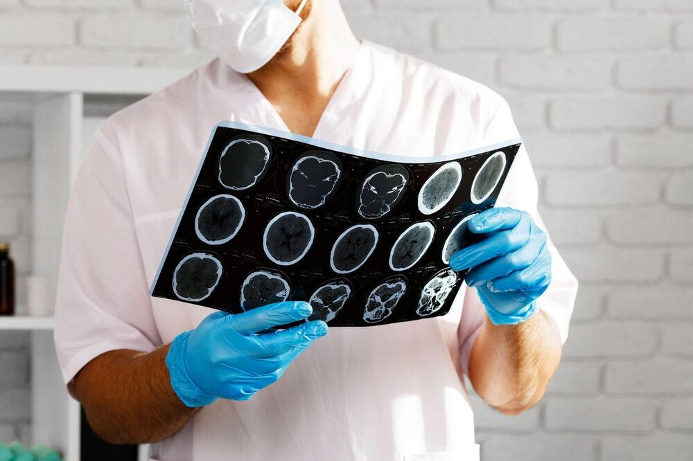 Demencija, Mentalno zdravlje, Mozak