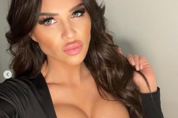 STANIJA IZUJEDANA PO ZADNJICI! Osvanula JEZIVA fotka koja je FRAPIRALA SVE! (FOTO)