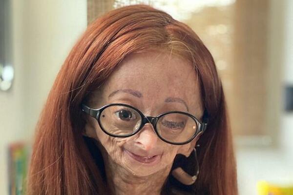 PREMINULA TINEJDŽERKA, TUGA!