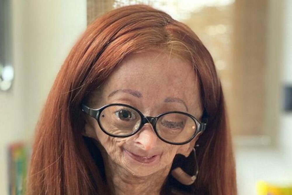 PREMINULA TINEJDŽERKA, TUGA!