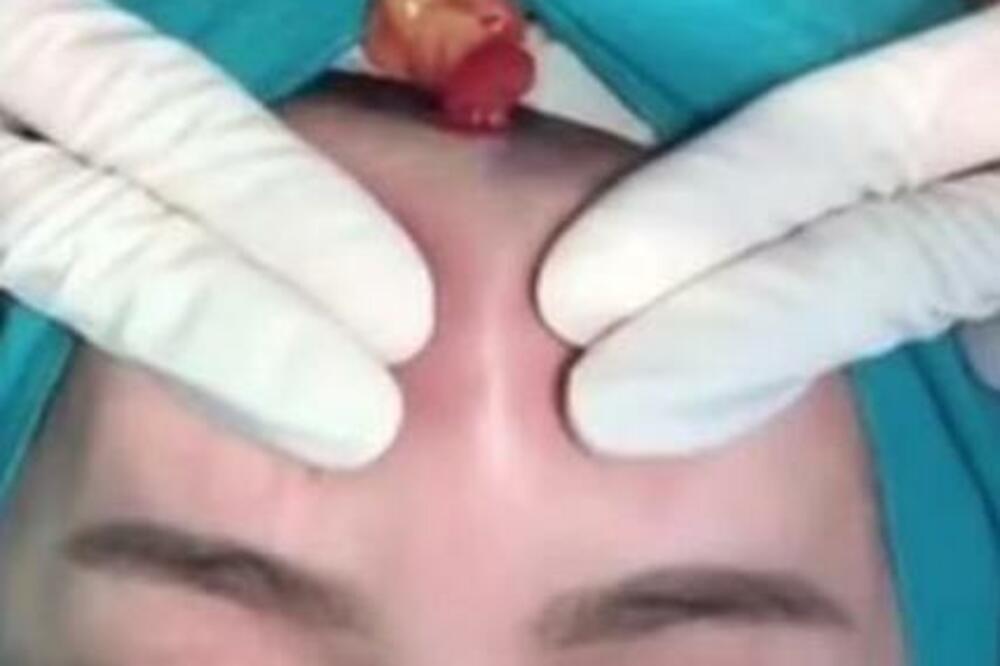 ŽENA JE KRENULA PO FILERE, A ZAMALO JE OSTALA BEZ GLAVE! Uznemirujući SADRŽAJ, ŽENO ZAŠTO TO SEBI RADIŠ? (VIDEO)