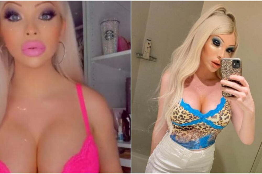 ŠTA SAD URADI, AU: Kraljica SILIKONA ne prestaje da ŠOKIRA! (FOTO)