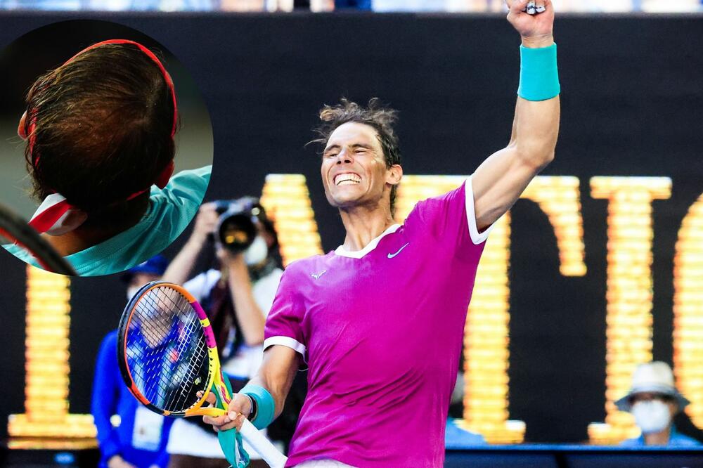 RAFA, KOJI ŠAMPON KORISTIŠ? Navijači URNISALI Nadala zbog FRIZURE! (FOTO)