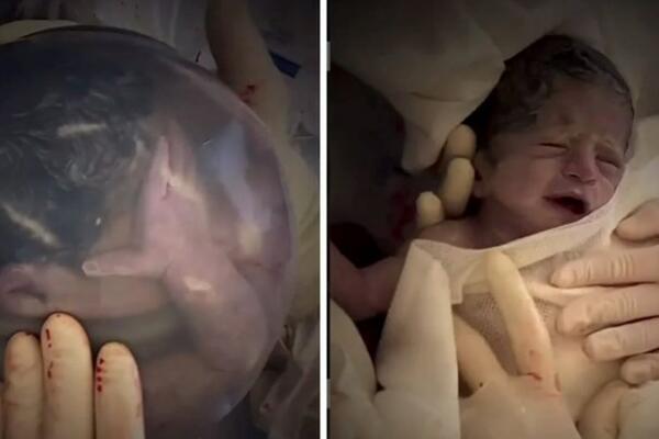 JEDAN U 80.000 SLUČAJEVA! Čudesan video BEBE rođene u vodenjaku, NEVEROVATNO (VIDEO)