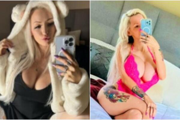 HEJTERIMA SASULA SVE U LICE: Sa PREDRASUDAMA se bori GOLIŠAVIM FOTKAMA! GORI kao VATRA i nije je BRIGA! (FOTO)