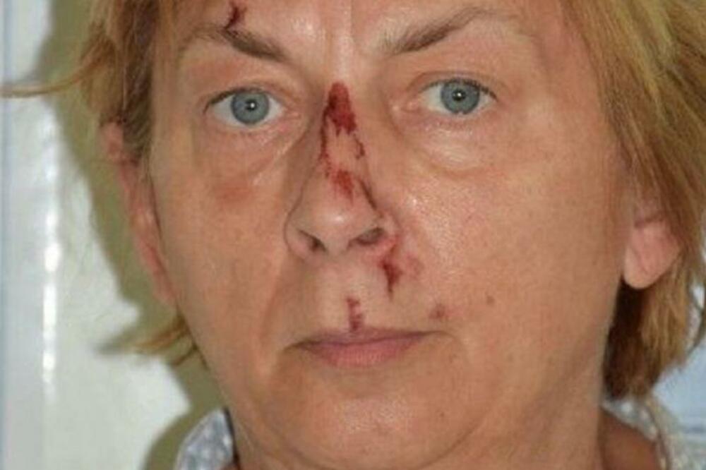 SLOVAKINJA SA KRKA TVRDI DA JE BILA OTETA! Trebala je da ode u ovu ZEMLJU, seća se ljudi koji su je KIDNAPOVALI