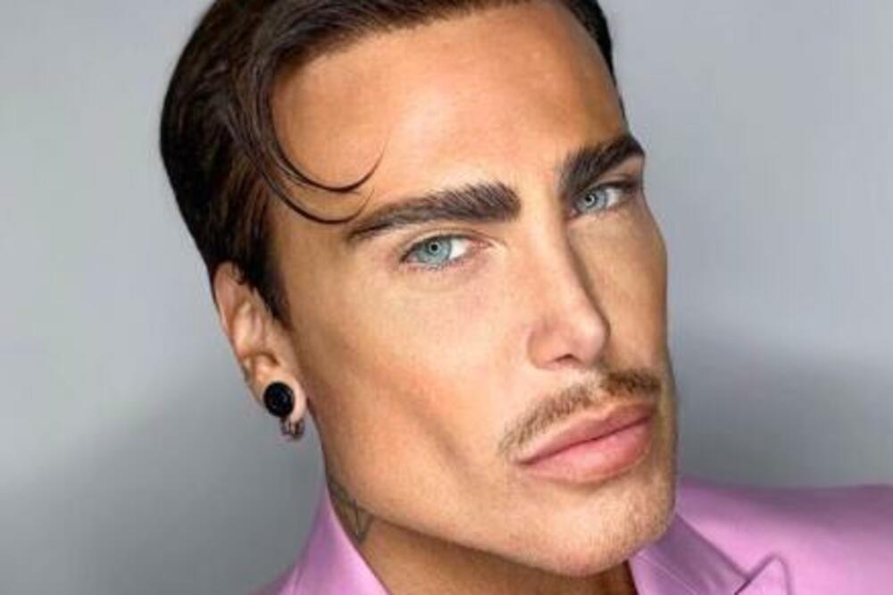 HIRURG MU ODSEKAO KOMAD USNE! Doživeo STRAVIČAN peh sa SILIKONIMA, tu nije kraj užasima učesnika RIJALITIJA (FOTO)