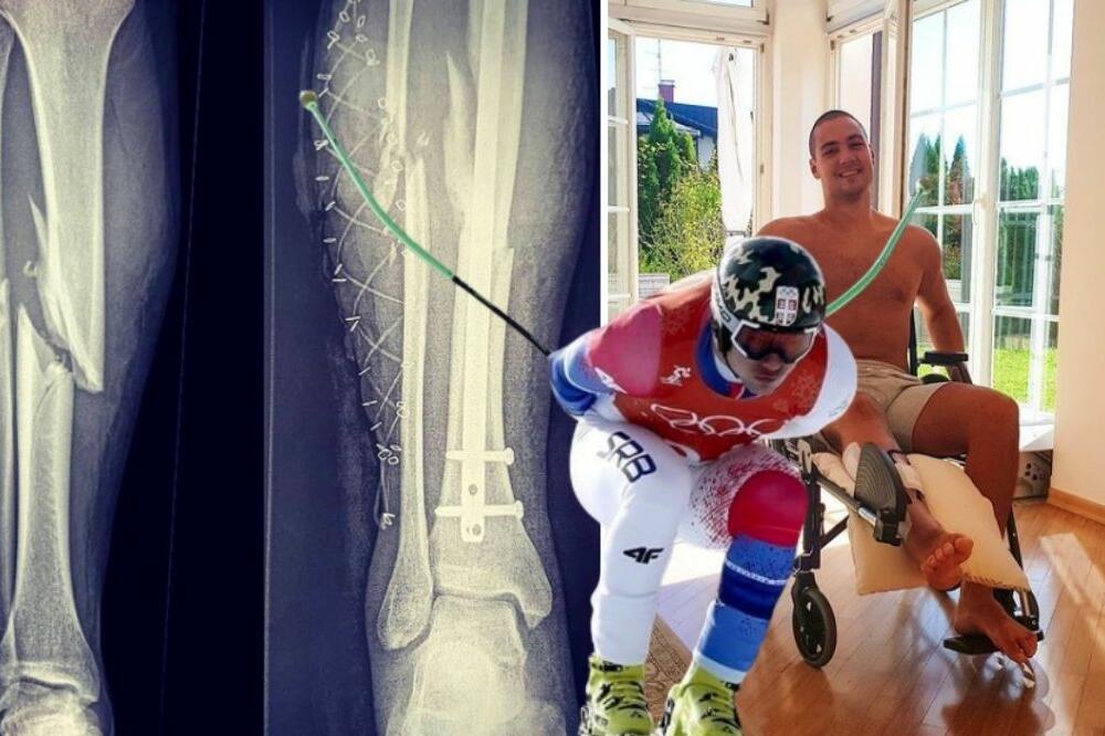 POSLE NESREĆE MARKO NIJE ZNAO DA LI ĆE PROHODATI PONOVO! METAL MU SPAJA KOSTI! DANAS NOSI ZASTAVU SRBIJE NA ZOI!