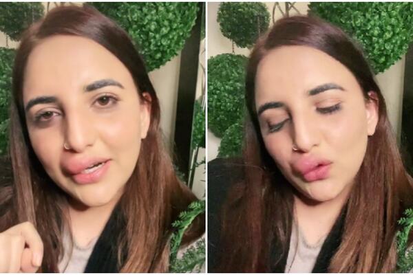 OTIŠLA DA POPUNI USNE FILERIMA, PA NAPUSTILA ORDINACIJU USRED PROCEDURE! Razlog tog poteza je NEVEROVATAN (VIDEO)