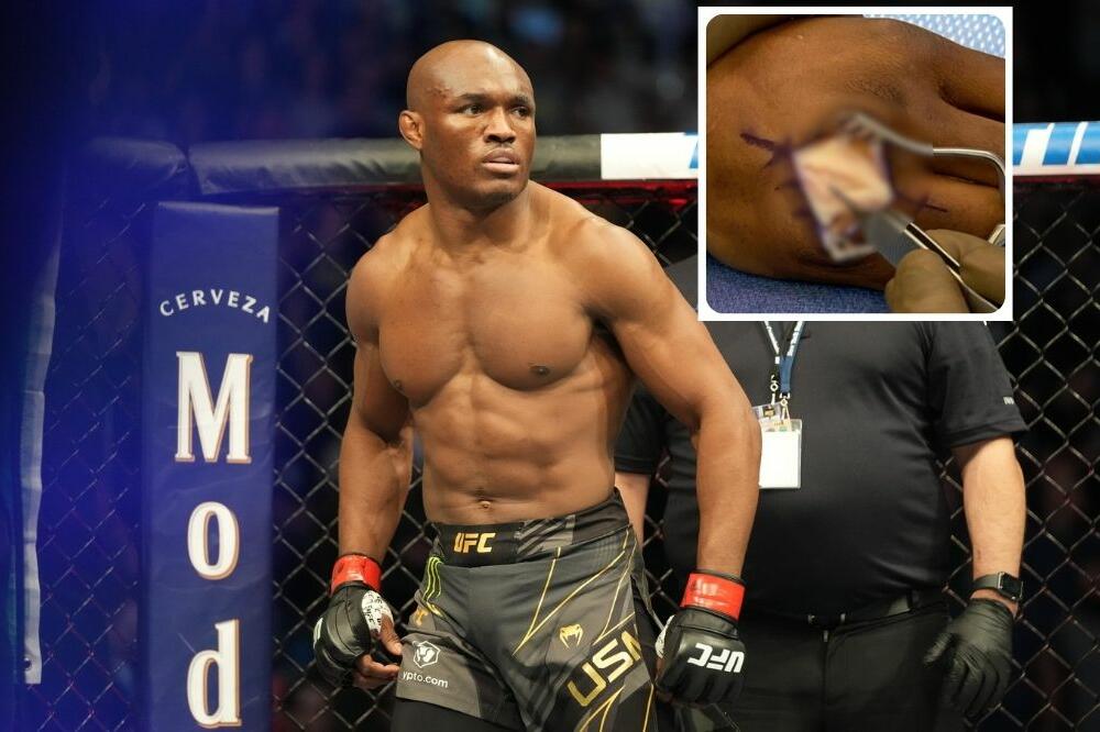 AHHH! SAMO ZA HRABRE! AKO STE GADLJIVI, BOLJE ZAOBIĐITE! ŠAMPION PODELIO SLIKU SA OPERACIJE ŠAKE! (VIDEO)