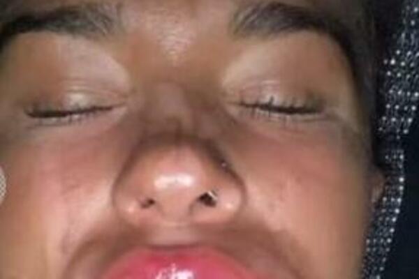 OVA UŽASNA STVAR SE KRIJE U FILERIMA ZA USNE: Nikako ne gledajte PUNOG ŽELUCA! (VIDEO)