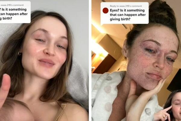 NOVOPEČENA MAMA OTKRILA ZASTRAŠUJUĆU POSLEDICU POROĐAJA! Jelena danima nije smela da se pogleda u OGLEDALU (VIDEO)