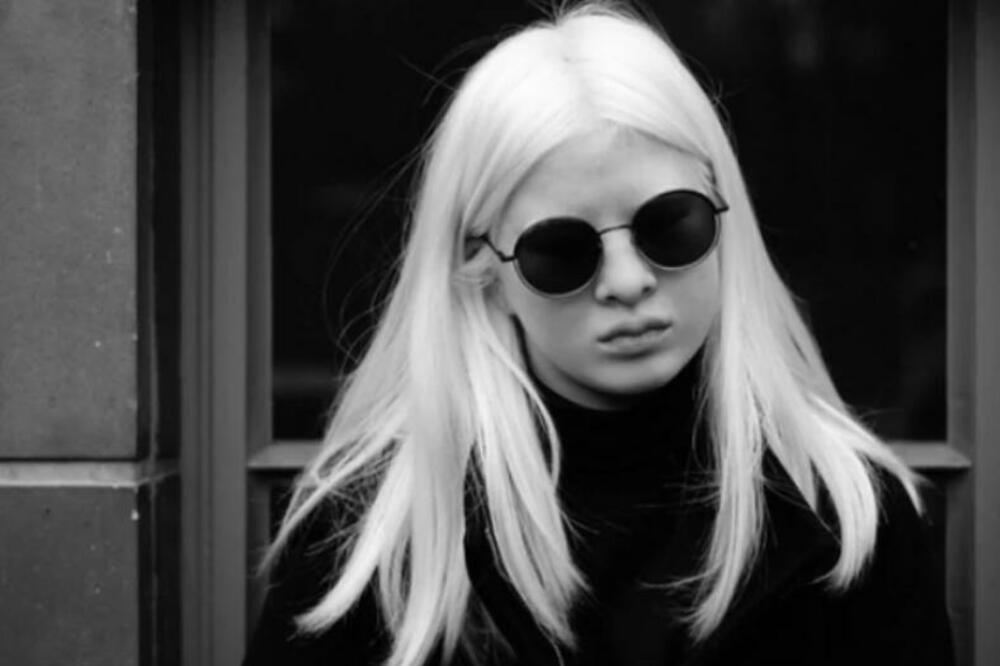 RODITELJI SU JE ODBACILI ZBOG ČUDNE BOLESTI, TVRDILI SU DA DONOSI PROKLETSTVO: Danas je nestvarno USPEŠNA MANEKENKA