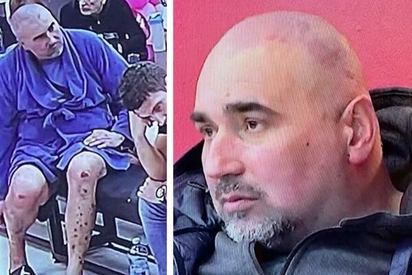 NAKON ŠTO SU MU SE OTVORILE ŽIVE RANE, DESIO SE NEOČEKIVANI OBRT: Svi gledaju u Mikija Đuričića i NE VERUJU! FOTO