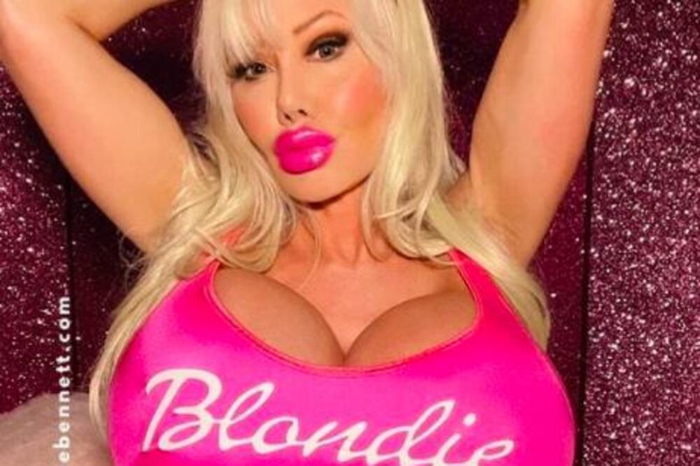 OČAJNIČKI ŽELI DA BUDE ŽIVA BARBIKA: Dala celo bogatstvo, njene grudi sada imaju 20 kg (FOTO)