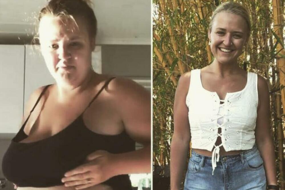 NEĆETE VEROVATI DA JE OVO ISTA ŽENA: Zbog onog što je radila BUKVALNO SE PREPOLOVILA (FOTO)