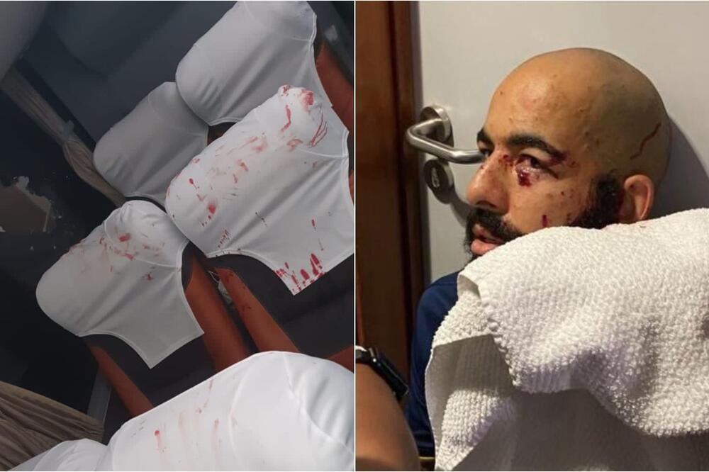 OVO NISU NI HULIGANI VEĆ TERORISTI: Bačena BOMBA na autobus fudbalera, izranjavani gelerima, KRV po sedištima! FOTO