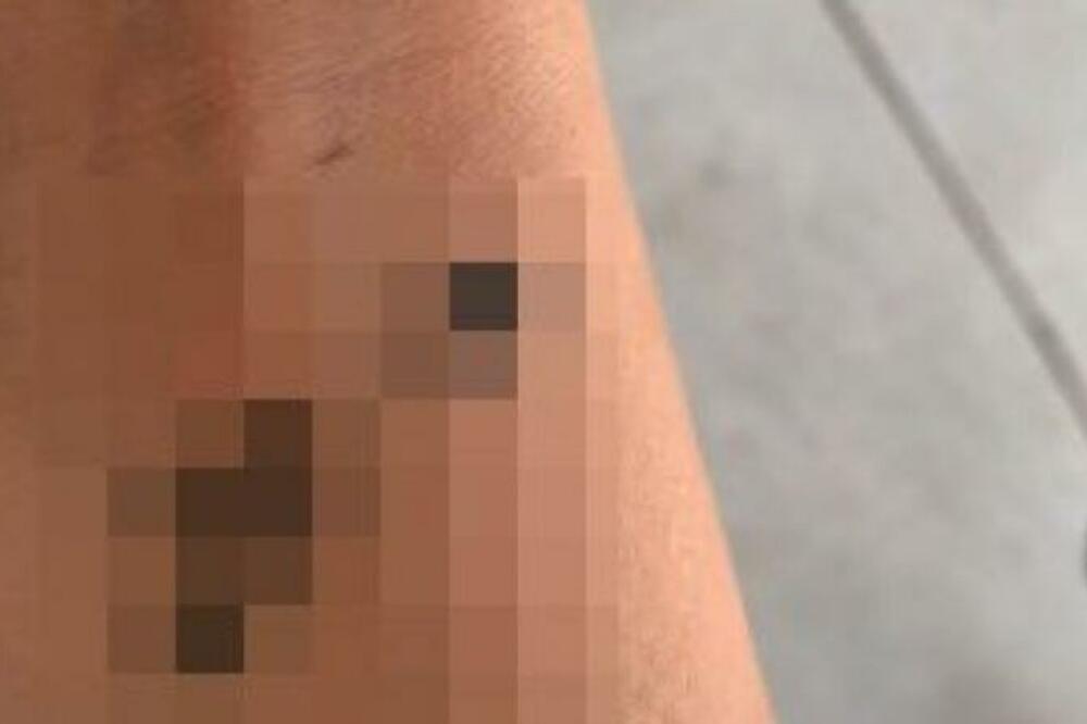 ZBOG NOVE TETOVAŽE RUGA JOJ SE CEO SVET: Ovo je KRIMINALNO, KO JOJ JE OVAKVU STVAR URADIO?! (VIDEO)