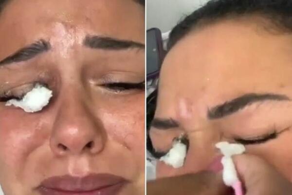 KAD KOZMETIČKI TRETMAN KRENE PO ZLU: Zbog VEŠTAČKIH TREPAVICA SKORO SLEPA! Jezivo! (VIDEO)